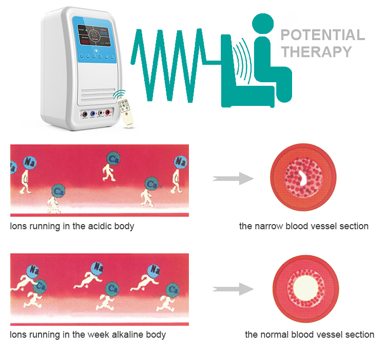 is high potential therapy effective 12